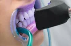 traitement taches brunes laser Tunisie