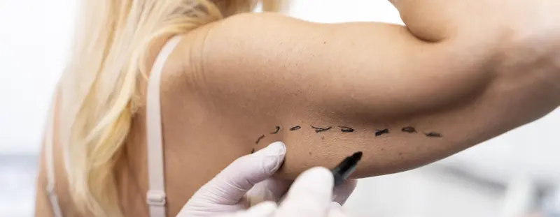 Lifting des bras RJMed en Tunisie