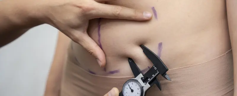 liposuccion Tunisie RJMed