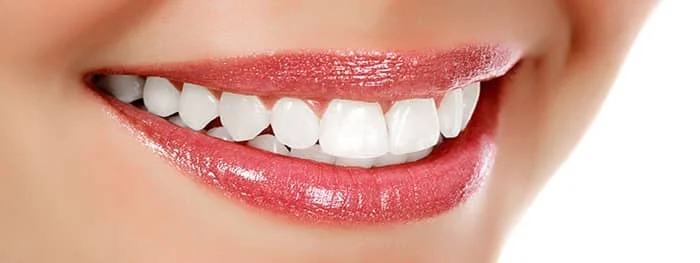 blanchiement dentaire au laser tunisie pas cher