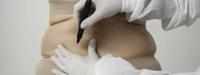 lipodissolution graisse et cellulite tunisie pas cher