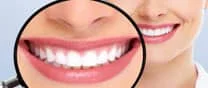 blanchiement dentaire pas cher Tunisie
