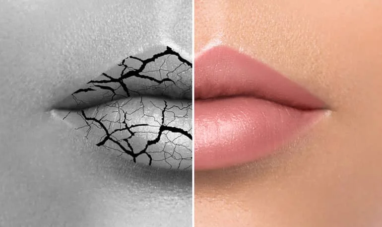 prix du peeling des lèvres en Tunisie 