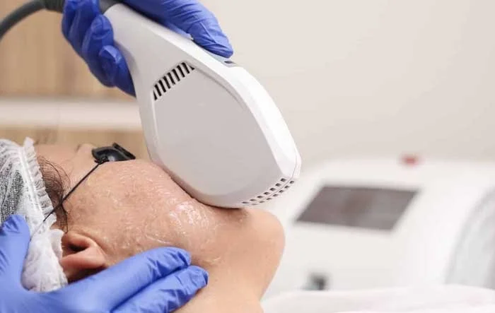 prix en dinars photorajeunissement visage avec laser pas cher