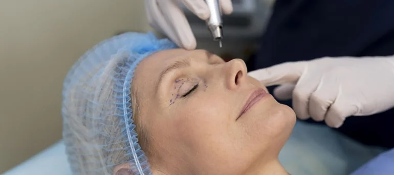 prix en dinars correction sans chirurgie des paupières Tunisie