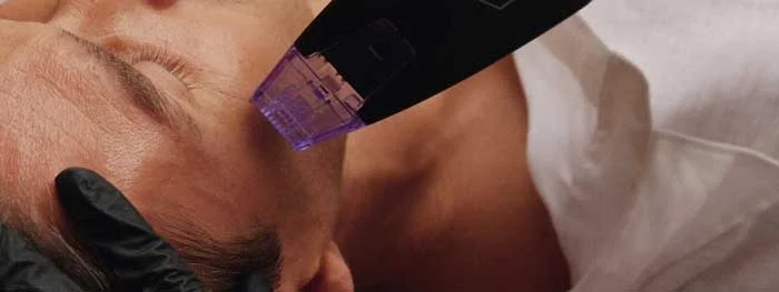 lifting peau visage morpheus8 tunisie pas cher